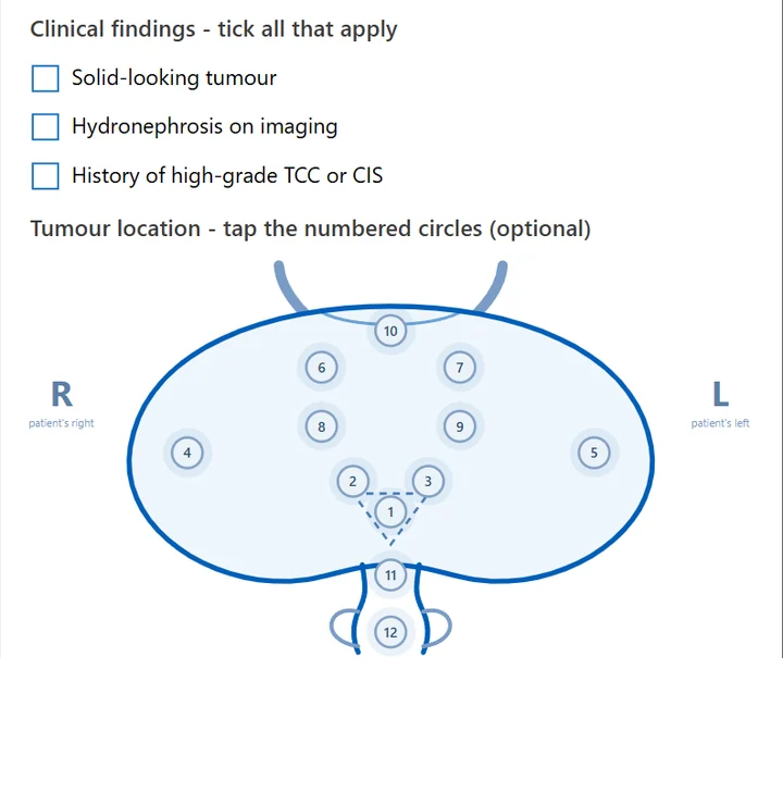 Bladder cancer waiting list card, tumour details step: clinical findings checkboxes and a numbered bladder map for marking tumour sites